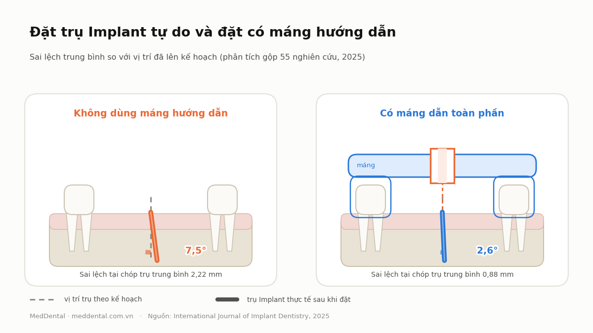 So sánh sai lệch vị trí trụ Implant giữa đặt tự do và có máng hướng dẫn