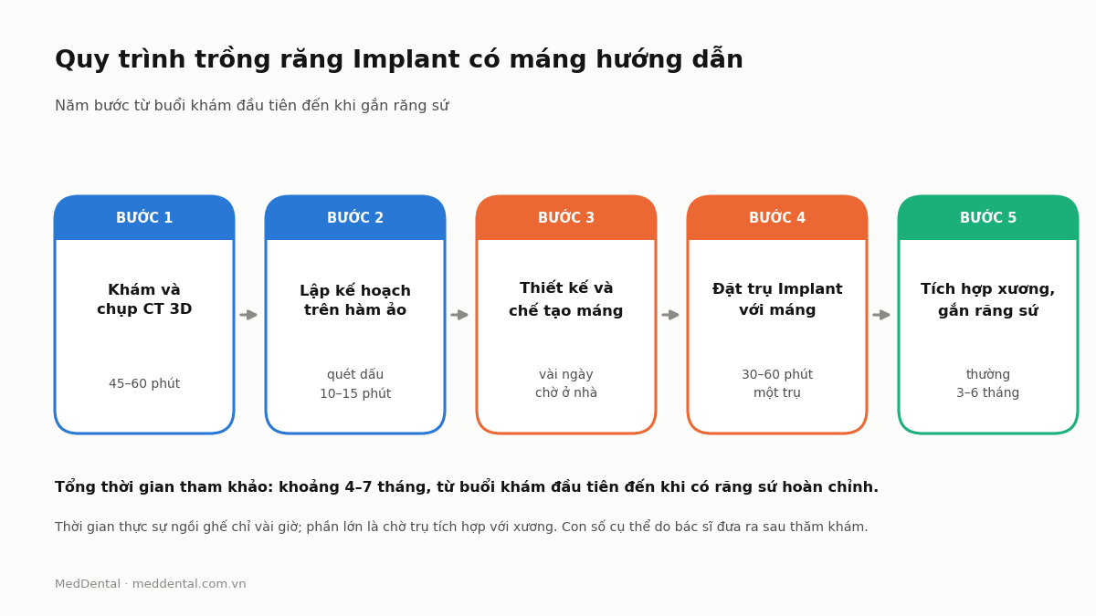 Sơ đồ 5 bước trồng răng Implant có máng hướng dẫn phẫu thuật